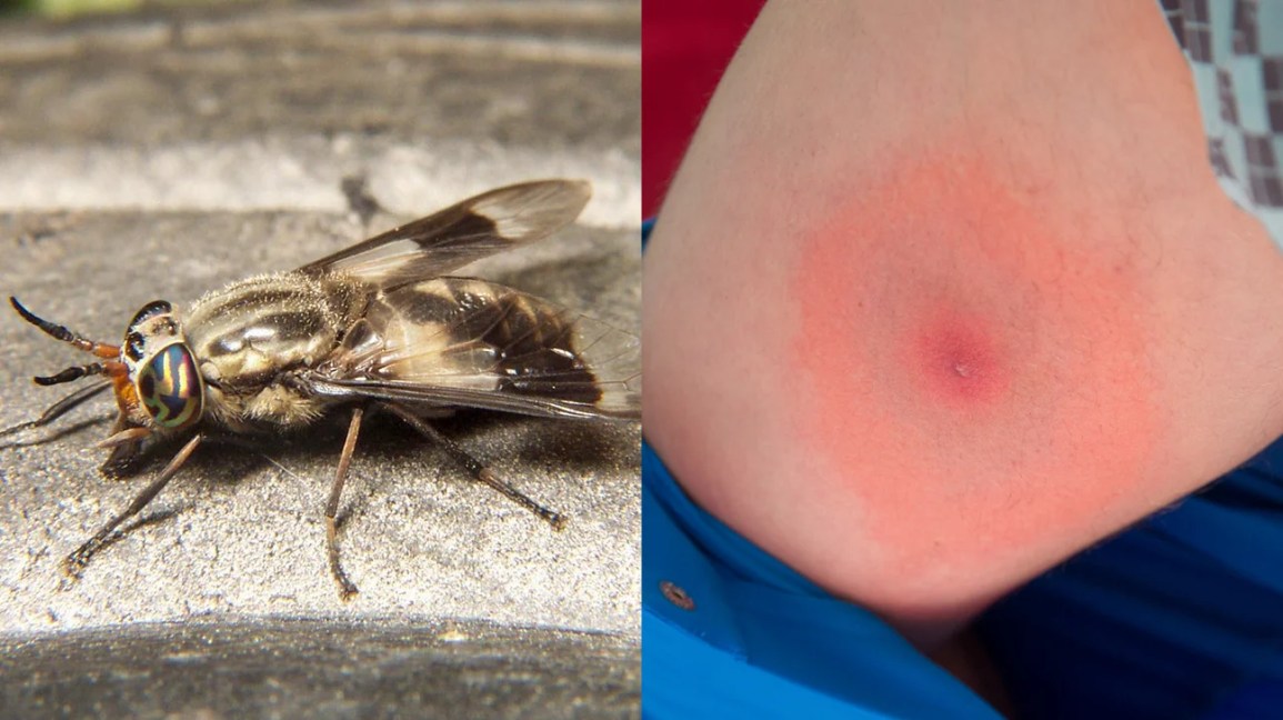 deer fly bite reaction